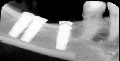 20190321/5c9345680ebc4.jpg 325.jpg