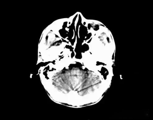 20190321/5c9345ac6e13c.jpg 326.jpg